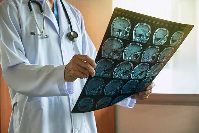 Doctor with stethoscope holding human brain MRI imaging in medical office