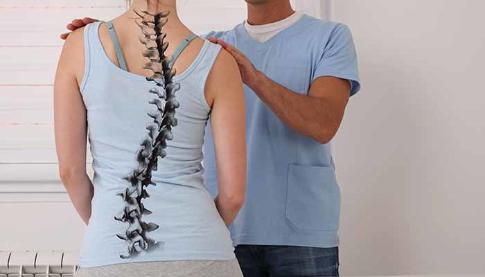 4 Types of Scoliosis & Their Causes