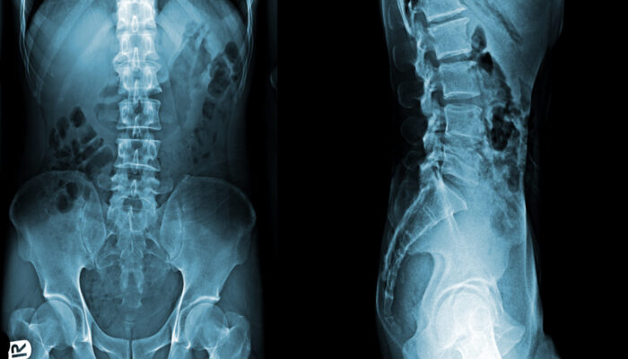 Diagnostic Imaging: What to Expect from an X-Ray Exam